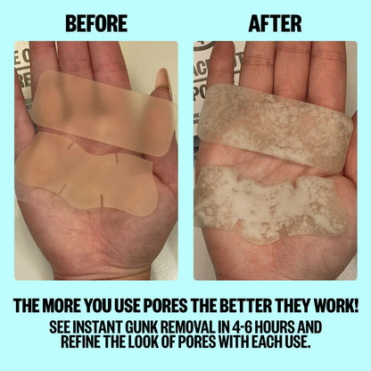 Pore Minimizing Strips (2boxes)